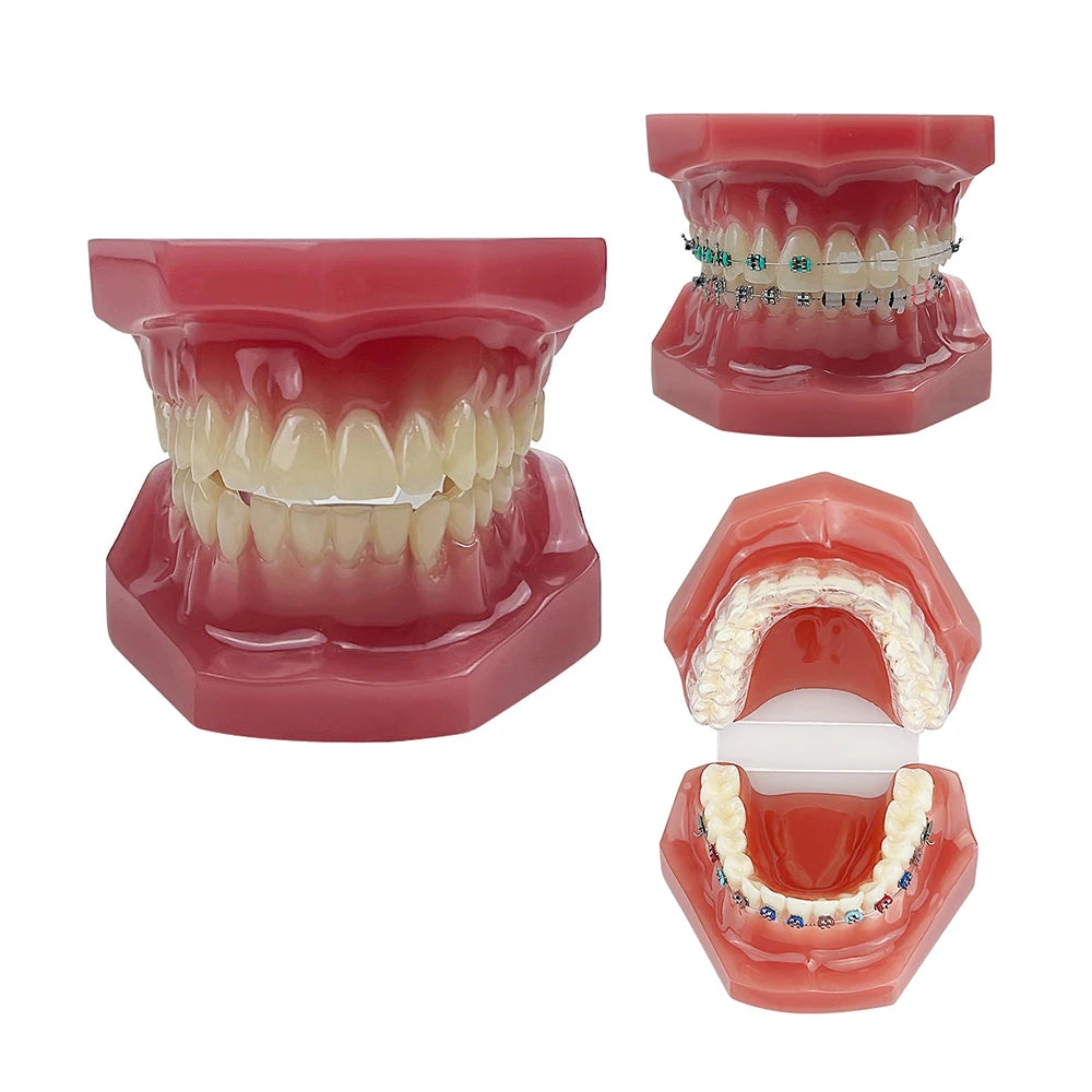 Modelo de enseñanza de ortodoncia, modelo oral articulado, hecho de cerámica con soporte de metal.